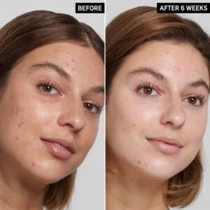THE INKEY LIST Salicylic Acid Cleanser - 150ml