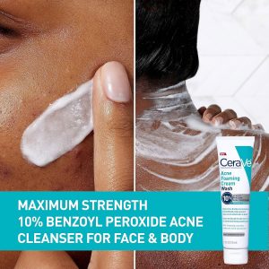CeraVe Acne Foaming Cream Wash with 10% Benzoyl Peroxide - 150ml