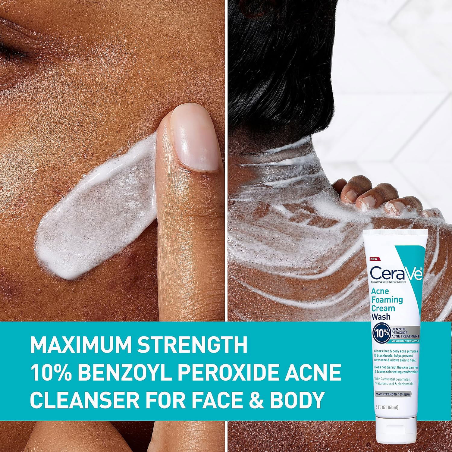 CeraVe Acne Foaming Cream Wash with 10 Benzoyl Peroxide 150ml SKINCARE SHOP