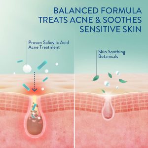 Cetaphil Gentle Clear Clarifying Acne Cream Cleanser - 124ml