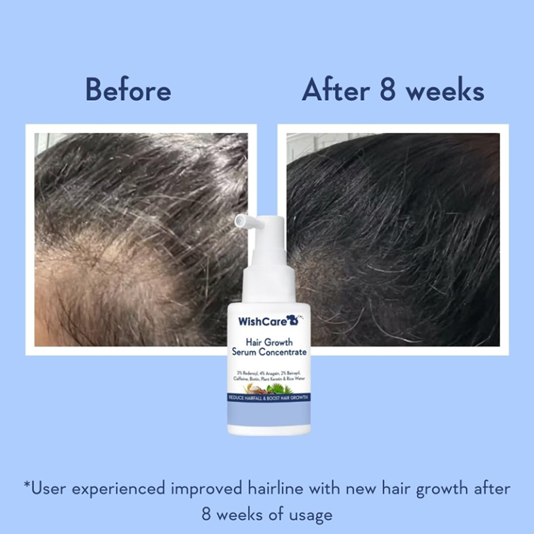 WishCare Hair Growth Serum - 30ml