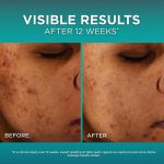 L’Oréal Paris Bright Reveal 12% [Niacinamide + Amino Sulfonic + Ferulic] Dark Spot Serum - 30ml