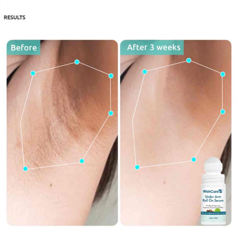 WishCare Under Arm Roll On Serum - 50ml