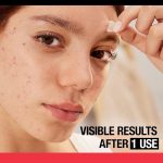 Neutrogena Stubborn Acne Ultra-Thin Blemish Patches, 24 Patches