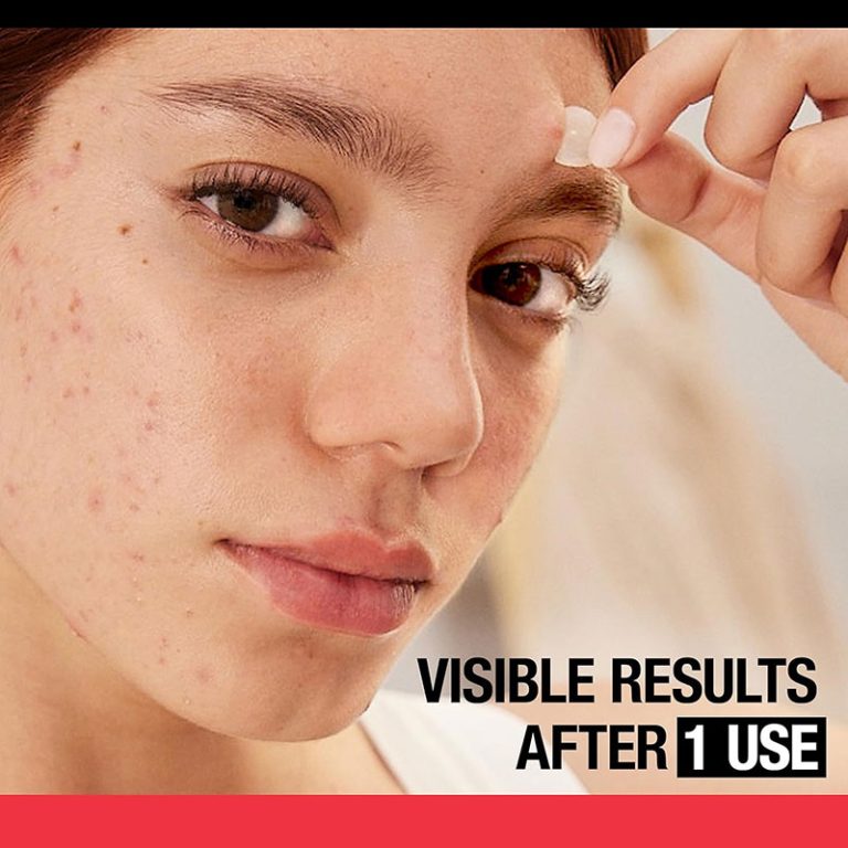 Neutrogena Stubborn Acne Ultra-Thin Blemish Patches, 24 Patches