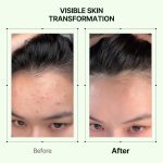 Orien Mugwort Soothe In Toner - 160ml