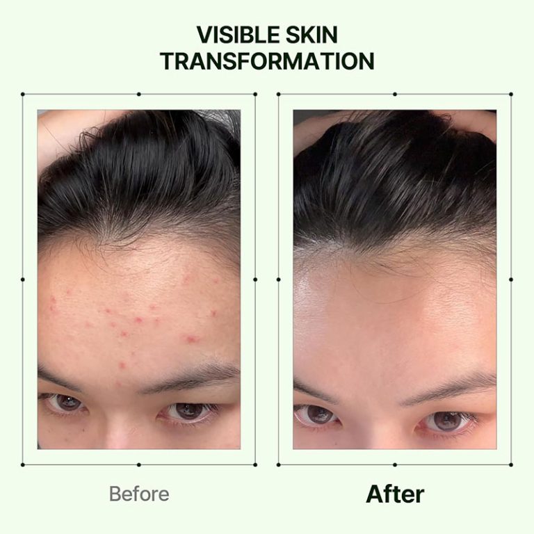 Orien Mugwort Soothe In Toner - 160ml