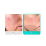 medicube Azelaic Acid 16 BB Soothing Serum - 30ml