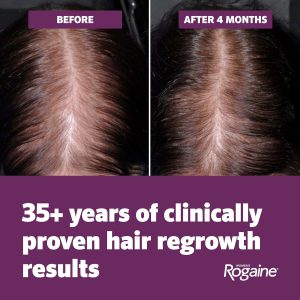 Rogaine Women's 5% Minoxidil Topical Aerosol Hair Regrowth Treatment 60g Two Cans